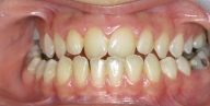 ustcene2